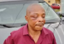 Worker’s Rights Campaign Condemns Attacks on the Labour Movement & Brutalisation of the NLC President in Imo State: This Series of Impunity Must Stop!